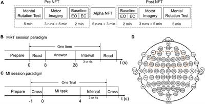 Neurofeedback Training of Alpha Relative Power Improves the Performance of Motor Imagery Brain-Computer Interface